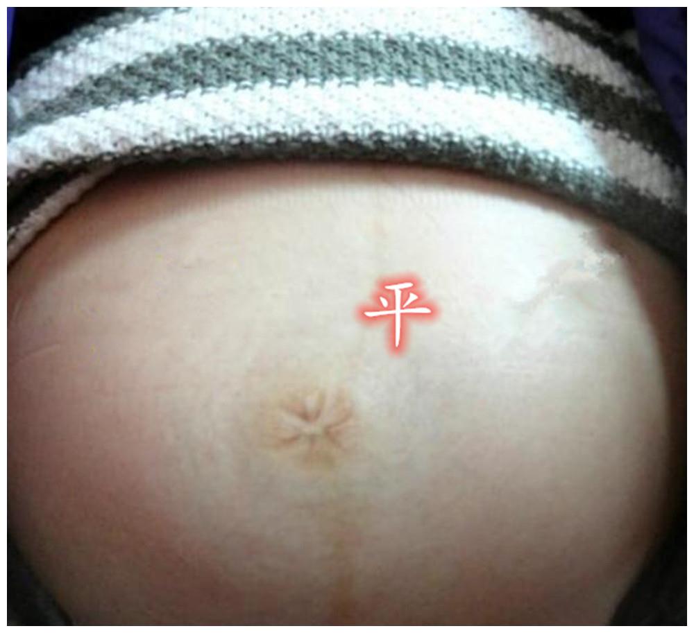 孕妇肚脐突起是被胎宝踢的吗?为何会有"凹凸平"之分?四个原因